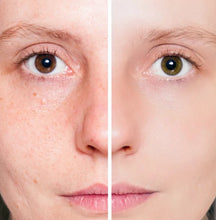 Cargar imagen en el visor de la galería, Gel exfoliante removedor de puntos negros / Pig Nose Clear Blackhead Steam Starter
