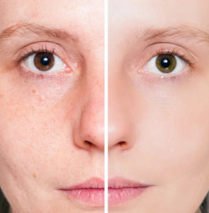 Gel exfoliante removedor de puntos negros / Pig Nose Clear Blackhead Steam Starter